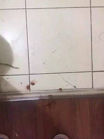 宜家水杯又發(fā)生爆炸事故 北京女子當場被炸暈